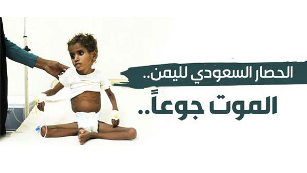 الحصار السعودي لليمن.. الموت جوعاً