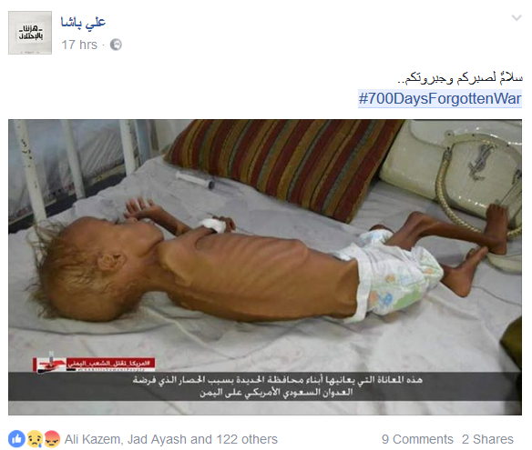 &rlm;#700DaysForgottenWar .. ناشطون يرفعون الصوت نصرة لليمن