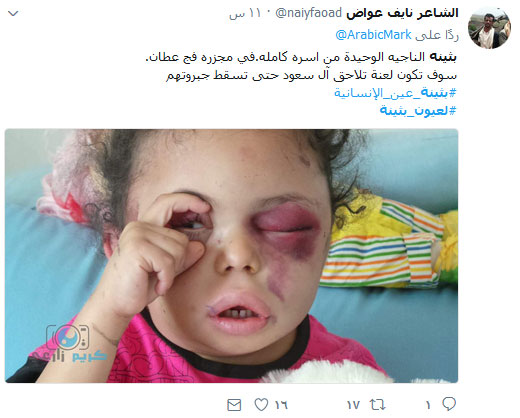 #لعيون_بثينة .. أوقفوا العدوان