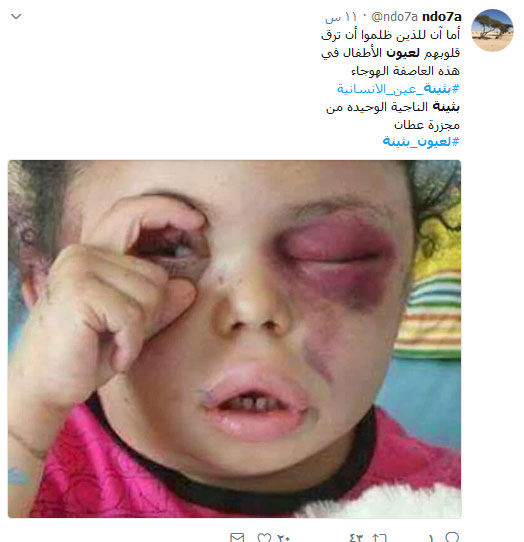 #لعيون_بثينة .. أوقفوا العدوان