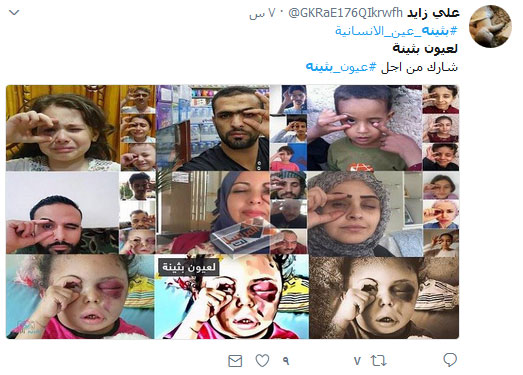 #لعيون_بثينة .. أوقفوا العدوان