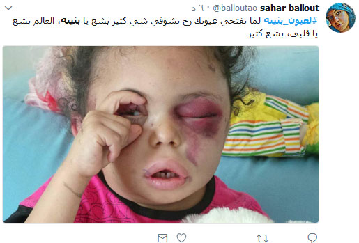 #لعيون_بثينة .. أوقفوا العدوان