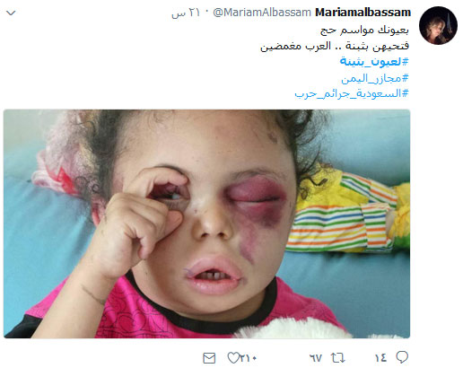 #لعيون_بثينة .. أوقفوا العدوان