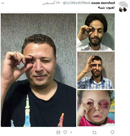 #لعيون_بثينة .. أوقفوا العدوان