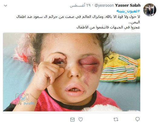 #لعيون_بثينة .. أوقفوا العدوان