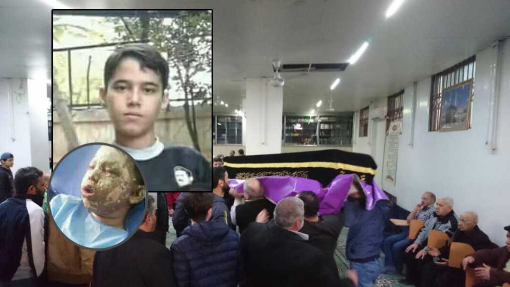 ماذا قال طفل حي ركن الدين الدمشقي لـ&rsquo;العهد&rsquo;؟.. عمر يستعيد وجهه الملائكي الذي أحرقه الإرهابيون