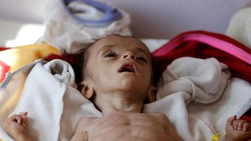 الصفحة الأجنبية: &rsquo;أنصار الله&rsquo; باتت اقوى من أي وقت مضى